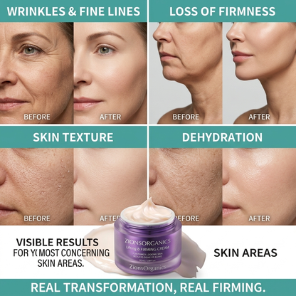 Advanced Lifting Cream
